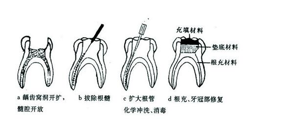 成都義齒廠家 成都義齒廠家
